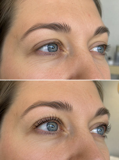Wimperliftset